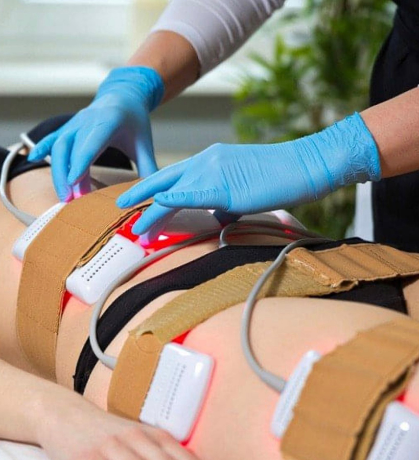 Laser Lipolysis