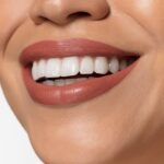Teeth Whitening