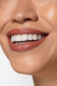 Teeth Whitening
