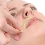 female mustache depilation