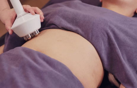 RF Sculpt Body Contouring