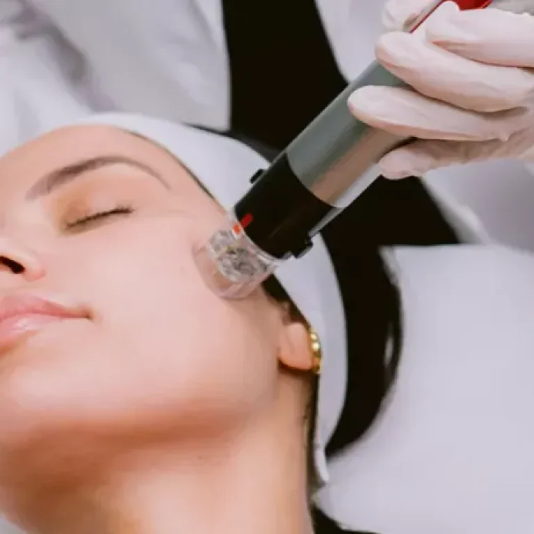 RF_Microneedling-1-1024x552