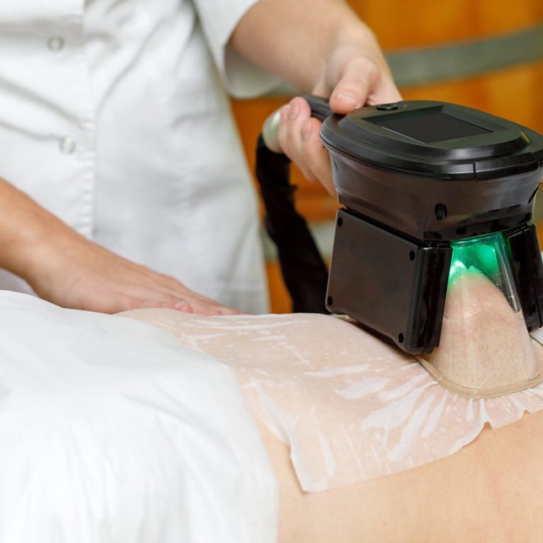 coolsculpting